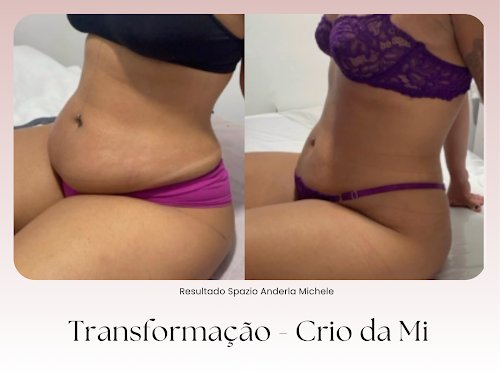 Emagrecimento sem cortes